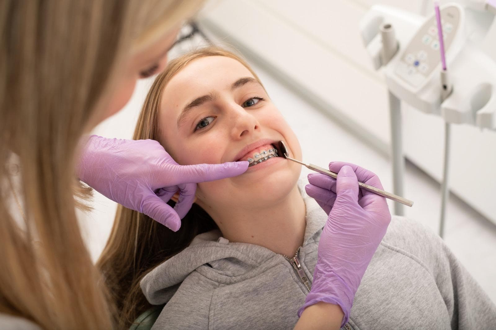 Boli li aparatić? Realna iskustva prvih tjedana fiksne terapije